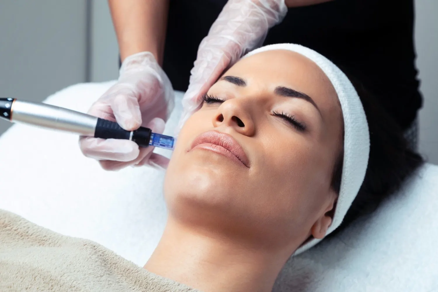 Woman getting microneedling treatment on face | Magnetic Aesthetics | Reno, NV