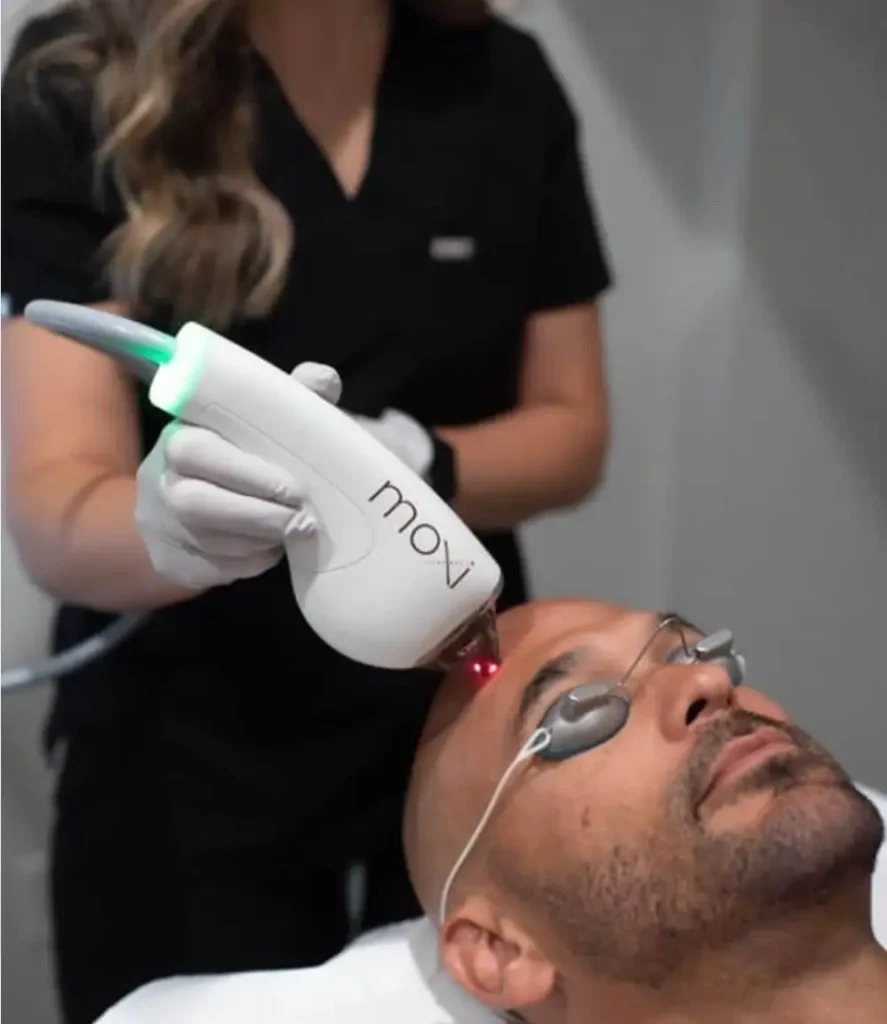 Sciton Moxi Laser for man | Magnetic Aesthetics | Reno, NV