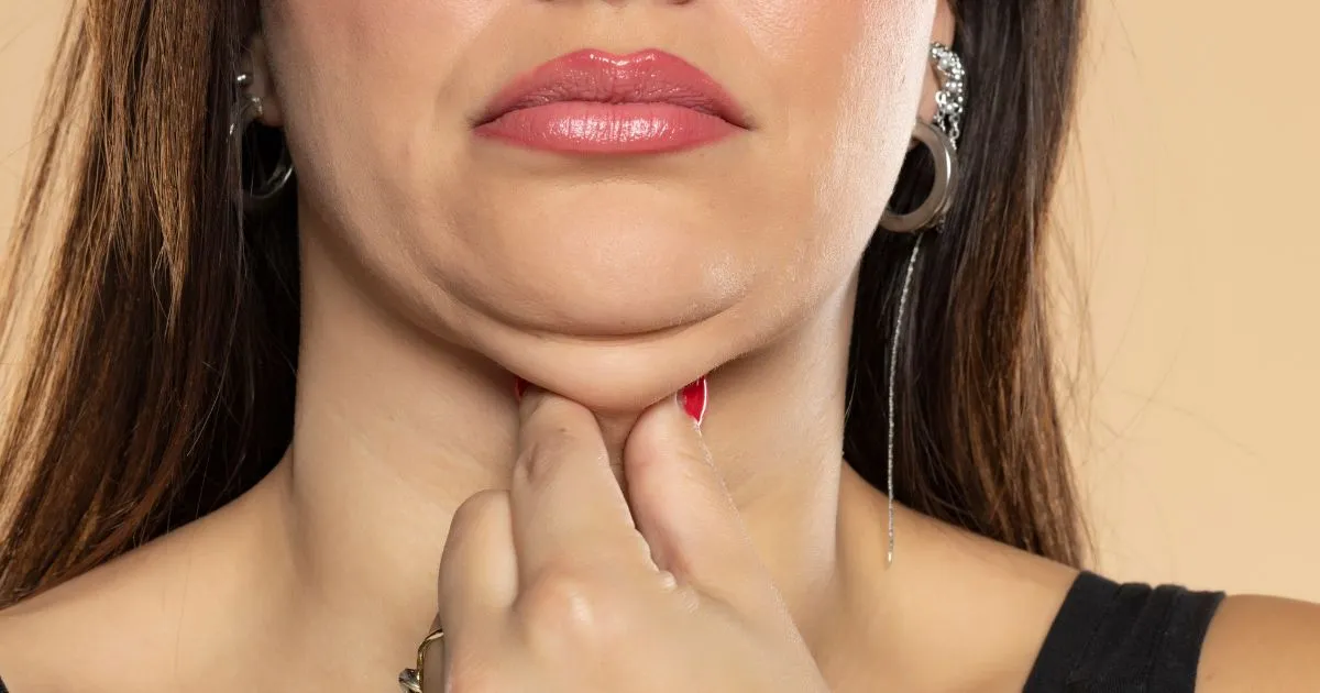 Close-up of a person with a double chin, considering Kybella treatment in Reno, NV